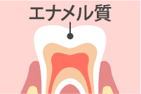 歯の色素沈着の原因 エナメル質形成不全症