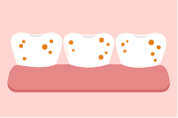 歯の色素沈着の原因 過剰なフッ化物