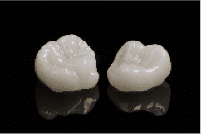 歯の色素沈着の対処法 セラミッククラウン
