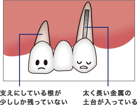 支えにしてる根が、少ししか残っていない