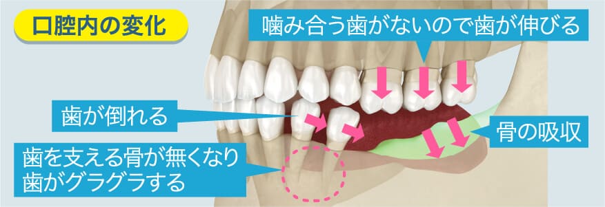 口腔内の変化