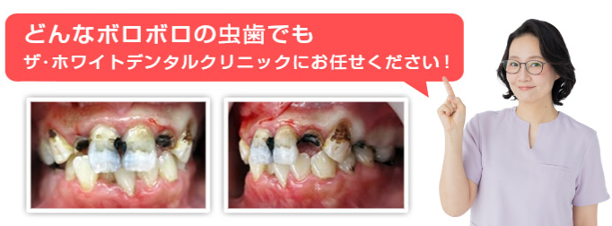 どんな歯でもお任せください!