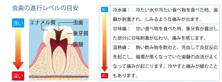 進行レベルの目安