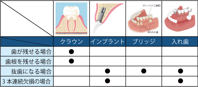 歯の状態や歯根の状態によって適用できる治療法を表した図