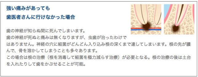 強い痛みがあっても歯医者さんに行けなかった場合