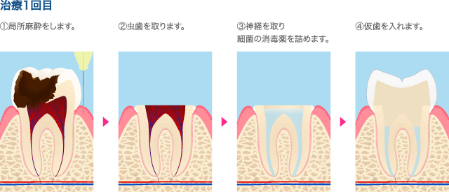 1回目