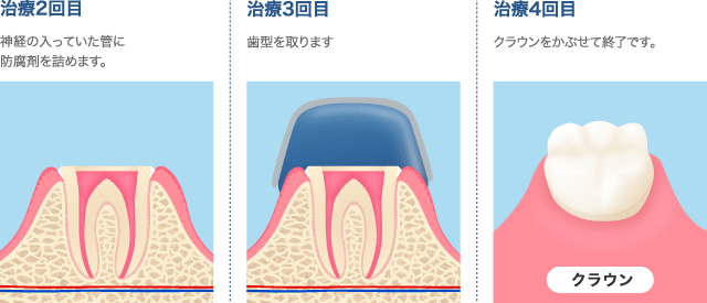 2回目～4回目