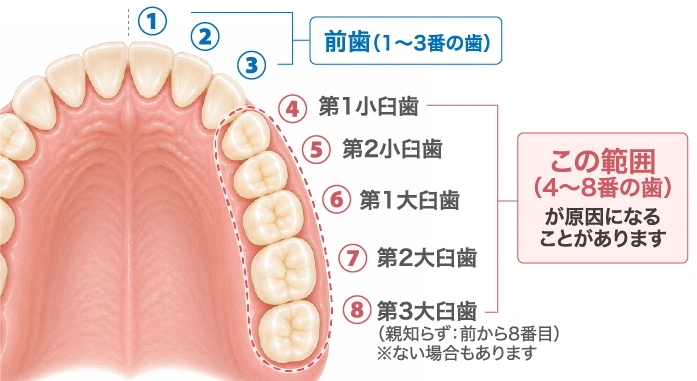 歯が原因かどうかを疑う手がかり
