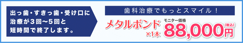 出っ歯、すきっ歯、受け口が3～5回の短期間で終了!ナチュラルセラミック