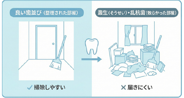 歯並びの良し悪しによる清掃性と汚れの蓄積の比較図
