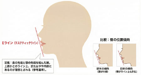 横顔の美しさの基準とされるEライン（鼻先と顎先を結ぶ線）の解説と、日本人・欧米人の傾向比較図