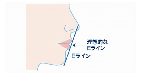横顔のEライン（エステティックライン）によるセルフチェック図解