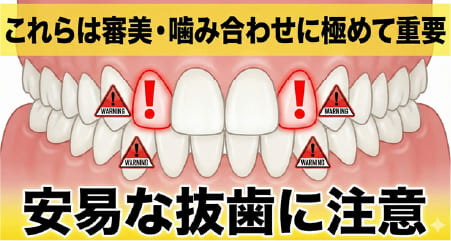 審美性・機能性に重要な前歯(側切歯)や犬歯(糸切り歯)の抜歯に対する警告図