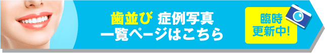 歯並び 症例写真一覧ページはこちら