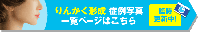 りんかく形成 症例写真一覧ページはこちら