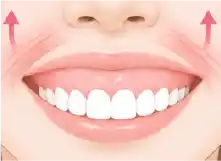 上唇を引き上げる筋肉の力が強い