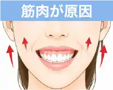 筋肉が原因