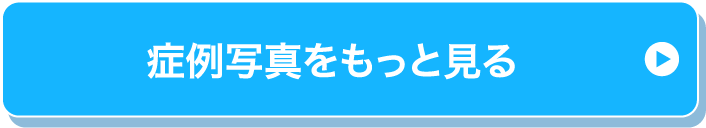 無料カウンセリング
