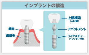 メーカーの保証期間