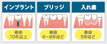 ブリッジや入れ歯との比較