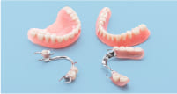 失った歯を補う代表的な施術「入れ歯」