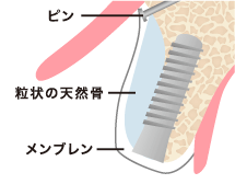 ステップ02　図