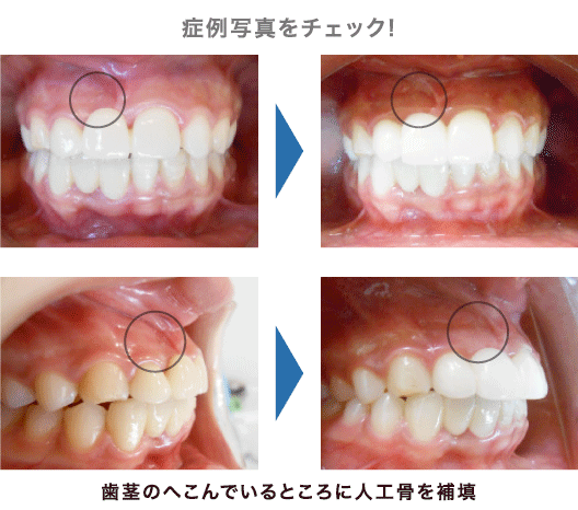 症例写真をチェック