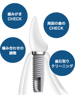 メンテナンス(定期健診)