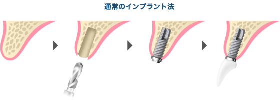 通常