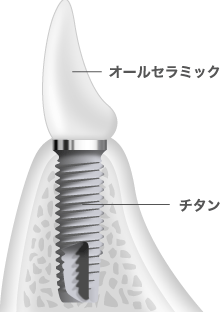 痛み止め以外の対処法