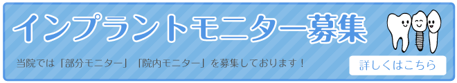 インプラントモニター募集