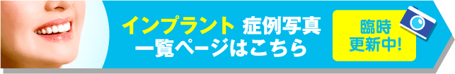 インプラント 症例写真一覧ページはこちら