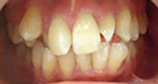 orthodontics