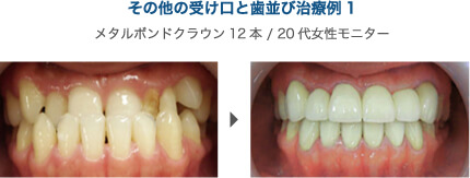 治療例1