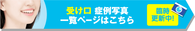 受け口 症例写真一覧ページはこちら