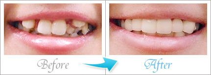 ビフォーアフター