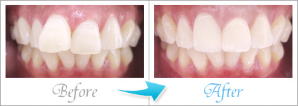 ビフォーアフター2