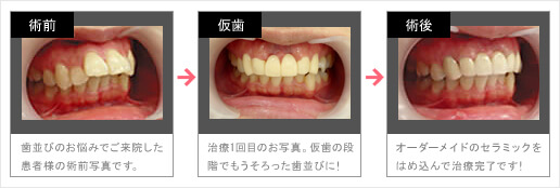 症例写真で見る治療の流れ