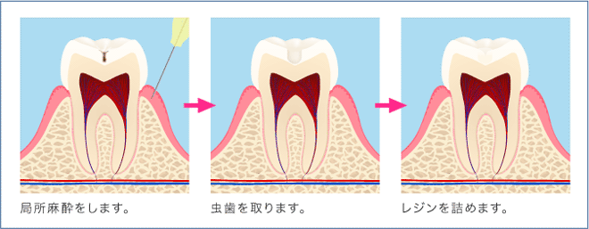 C1工程