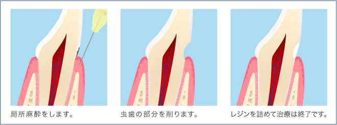 工程