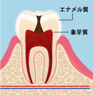 痛みはないが、達している場合