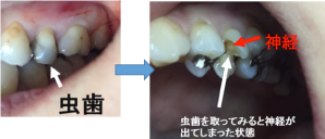 痛みはないが、達している場合