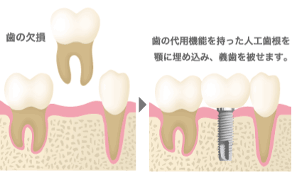 その他の方法