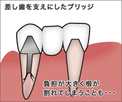 支えにした