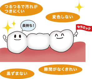当院はセラミックのみ取り扱っております