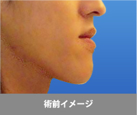 シミュレーション
