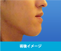 シミュレーション
