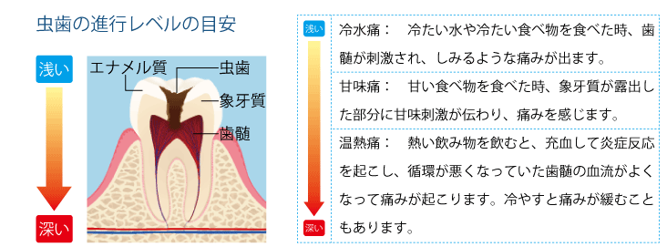 進行レベルの目安