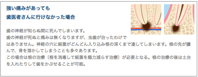 強い痛みがあっても歯医者さんに行けなかった場合