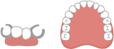 レジン床義歯